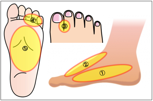 足 の 裏 が 痺れる