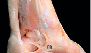 足関節　膜組織